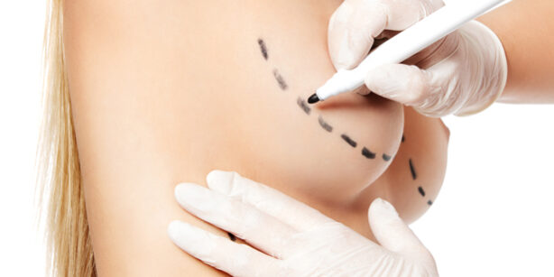 chirurgia-plastica-ricostruttiva-post-mastectomia