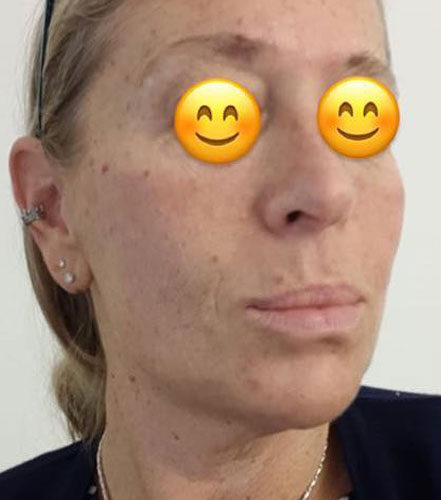 Dopo