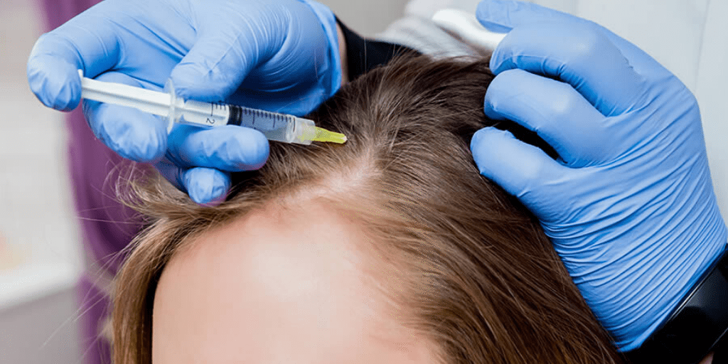 esosomi capelli esosomi capelli