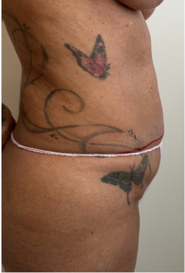 keyPhoto_F012C6FF-37D9-436F-AB95-6A2727797D2B copia