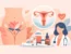 Medicina intima femminile e soluzioni mirate