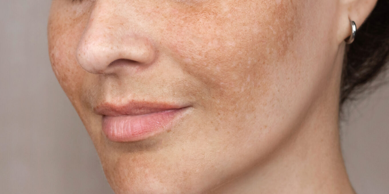 PREPARAZIONE PARTO -macchie