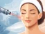 Laser resurfacing viso per una pelle più levigata