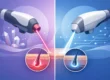Laser Alessandrite vs diodo: quale scegliere?