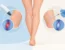 Laser vascolare versus scleroterapia: quale scegliere?
