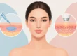 Filler e biostimolazione cutanea a confronto