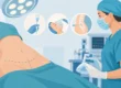 Quale anestesia per addominoplastica scegliere?
